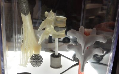 Fabricación de implantes 3D y dispositivos médicos.
